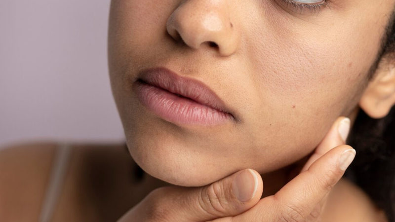 L’Oréal Groupe presentó Melasyl, una molécula para el campo de la hiperpigmentación de la piel