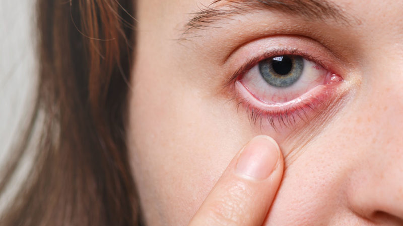 Cómo prevenir el ojo seco, un problema que cada vez afecta a más personas